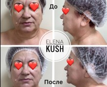 Профессиональный массаж и аппаратный уход