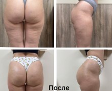 Профессиональный массаж и аппаратный уход