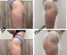 Профессиональный массаж и аппаратный уход