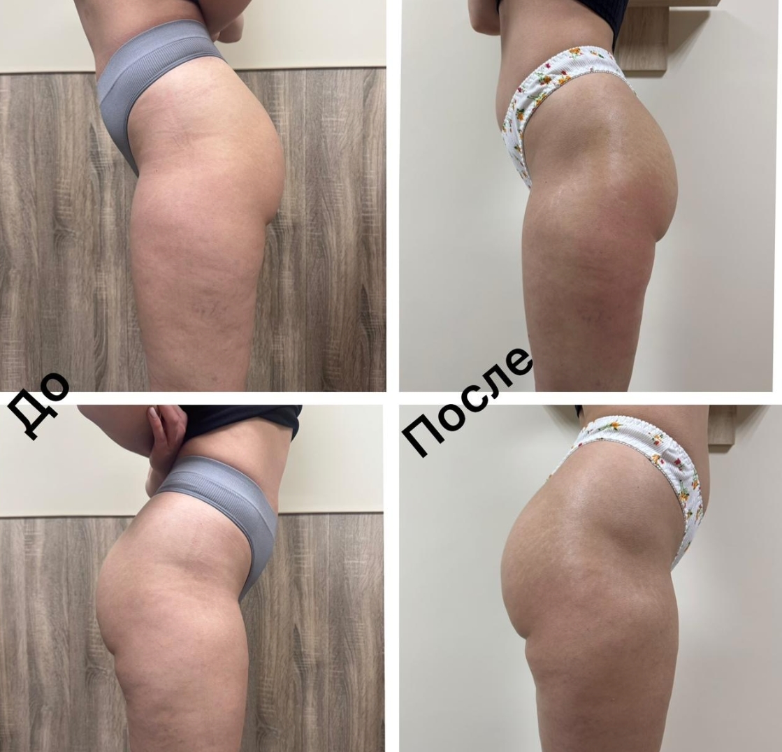 Ручной массаж и аппаратный уход за телом и лицом